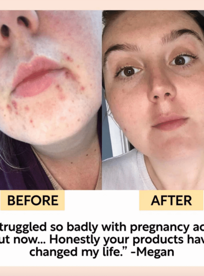 Face Moisturiser with Vitamin E + Aloe Vera 60 ml.